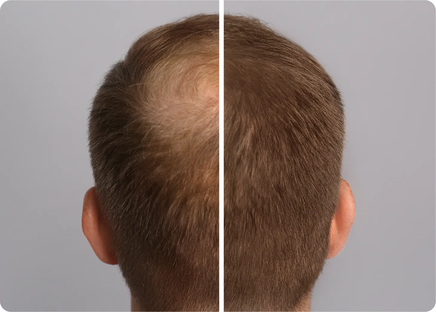Kolors Hair & Skin Clinic - Advanced treatment for hair and skin